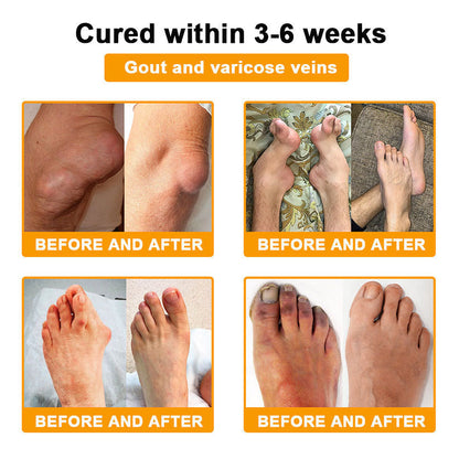 Lotmay® Bee Venom Pain Relief Joint Repair Cream 🐝🐝(Specially for older adults & AOA commends)