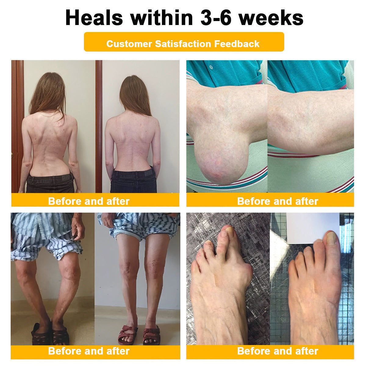 Lotmay® Bee Venom Pain Relief Joint Repair Cream 🐝🐝(Specially for older adults & AOA commends)