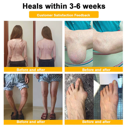 Lotmay® Bee Venom Pain Relief Joint Repair Cream 🐝🐝(Specially for older adults & AOA commends)