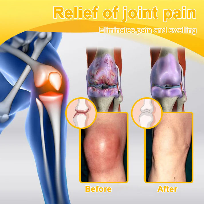 Lotmay® Bee Venom Pain Relief Joint Repair Cream 🐝🐝(Specially for older adults & AOA commends)