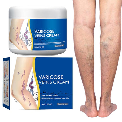 Varicose Veins Cream for Legs, Spider Varicose Veins Cream, Skin Creams for Legs Treatment