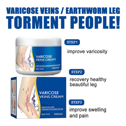 Varicose Veins Cream for Legs, Spider Varicose Veins Cream, Skin Creams for Legs Treatment