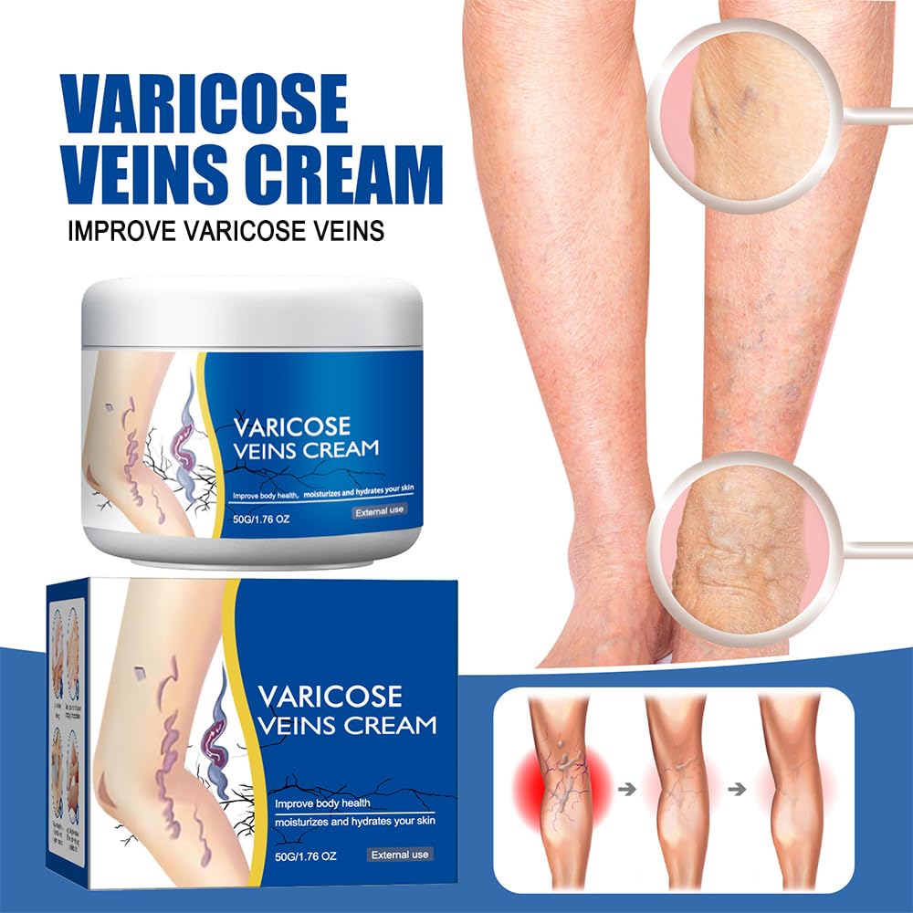 Varicose Veins Cream for Legs, Spider Varicose Veins Cream, Skin Creams for Legs Treatment