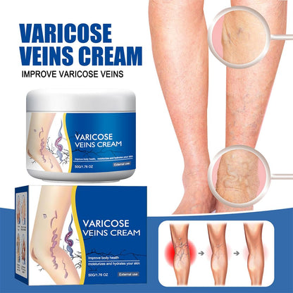 Varicose Veins Cream for Legs, Spider Varicose Veins Cream, Skin Creams for Legs Treatment