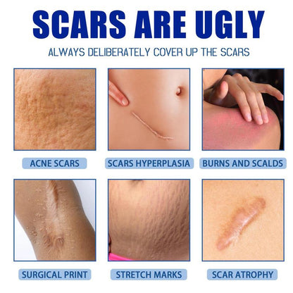 Professional Scar Removal Gel