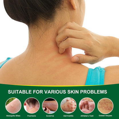 SanNuo Sensitive Skin Relief Cream 🌿 Soothes Eczema, Blisters & Itchy Dry Skin | Fragrance-Free, Gentle Oatmeal Formula