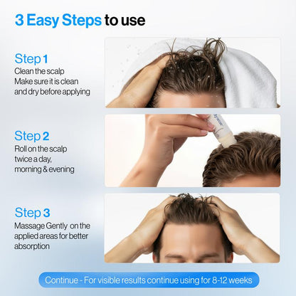 Hair Growth Serum 🚀 | 3% Rosemary & DHT Blocker | Non-Oily Roll-On 💧