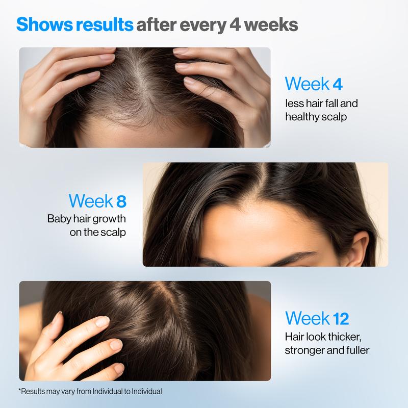 Hair Growth Serum 🚀 | 3% Rosemary & DHT Blocker | Non-Oily Roll-On 💧